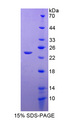 SERPINB4 / SCCA1+2 Protein - Recombinant  Squamous Cell Carcinoma Antigen 1/2 By SDS-PAGE