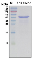 SERPINB5 / Maspin Protein - SDS-PAGE under reducing conditions and visualized by Coomassie blue staining