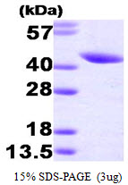 SERPINB5 / Maspin Protein