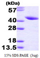SERPINB5 / Maspin Protein