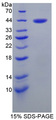 SERPINB6 / PI-6 Protein - Recombinant  Placental Thrombin Inhibitor By SDS-PAGE