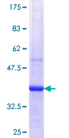 SERPINB7 / MEGSIN Protein - 12.5% SDS-PAGE Stained with Coomassie Blue.