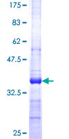 SERPINB9 / PI9 Protein - 12.5% SDS-PAGE Stained with Coomassie Blue.