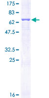 SERPINE1 / PAI-1 Protein - 12.5% SDS-PAGE of human SERPINE1 stained with Coomassie Blue