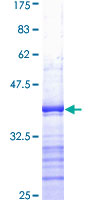 SERPINE1 / PAI-1 Protein - 12.5% SDS-PAGE Stained with Coomassie Blue.