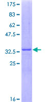 SERPINE2 / Nexin Protein - 12.5% SDS-PAGE Stained with Coomassie Blue.
