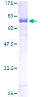 SERPINF1 / PEDF Protein - 12.5% SDS-PAGE of human SERPINF1 stained with Coomassie Blue