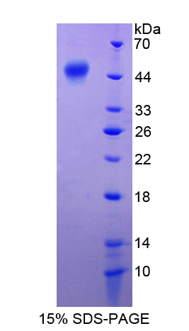 SERPINF1 / PEDF Protein - Recombinant  Pigment Epithelium Derived Factor By SDS-PAGE