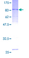 SERPING1 / C1 Inhibitor Protein - 12.5% SDS-PAGE of human SERPING1 stained with Coomassie Blue