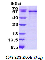 SERPING1 / C1 Inhibitor Protein