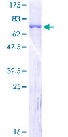 SERPINH1 / HSP47 Protein - 12.5% SDS-PAGE of human SERPINH1 stained with Coomassie Blue