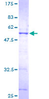 SERTAD1 / TRIP-Br1 / SEI-1 Protein - 12.5% SDS-PAGE of human SERTAD1 stained with Coomassie Blue