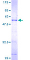SERTAD1 / TRIP-Br1 / SEI-1 Protein - 12.5% SDS-PAGE of human SERTAD1 stained with Coomassie Blue