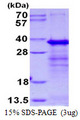 SERTAD1 / TRIP-Br1 / SEI-1 Protein