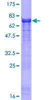 SERTAD2 Protein - 12.5% SDS-PAGE of human SERTAD2 stained with Coomassie Blue
