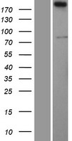 SERTAD3 Protein - Western validation with an anti-DDK antibody * L: Control HEK293 lysate R: Over-expression lysate