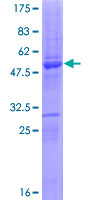 SERTAD3 Protein - 12.5% SDS-PAGE of human SERTAD3 stained with Coomassie Blue