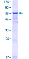 SERTAD4 Protein - 12.5% SDS-PAGE of human SERTAD4 stained with Coomassie Blue