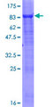 SESN2 / HI95 Protein - 12.5% SDS-PAGE of human SESN2 stained with Coomassie Blue