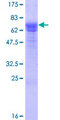 SESN3 Protein - 12.5% SDS-PAGE of human SESN3 stained with Coomassie Blue