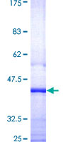 SESN3 Protein - 12.5% SDS-PAGE Stained with Coomassie Blue.