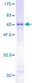 SET / TAF-I Protein - 12.5% SDS-PAGE of human SET stained with Coomassie Blue