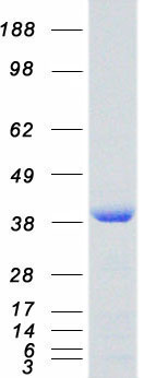 SET / TAF-I Protein - Purified recombinant protein SET was analyzed by SDS-PAGE gel and Coomassie Blue Staining