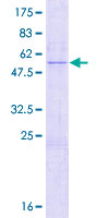 SETBP1 / SEB Protein - 12.5% SDS-PAGE of human SETBP1 stained with Coomassie Blue