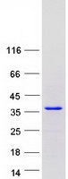 SETBP1 / SEB Protein - Purified recombinant protein SETBP1 was analyzed by SDS-PAGE gel and Coomassie Blue Staining
