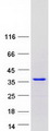 SETBP1 / SEB Protein - Purified recombinant protein SETBP1 was analyzed by SDS-PAGE gel and Coomassie Blue Staining