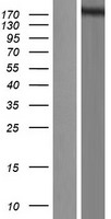 SETD1A / SET1 Protein - Western validation with an anti-DDK antibody * L: Control HEK293 lysate R: Over-expression lysate
