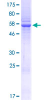 SETD3 Protein - 12.5% SDS-PAGE of human SETD3 stained with Coomassie Blue