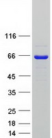 SETD3 Protein - Purified recombinant protein SETD3 was analyzed by SDS-PAGE gel and Coomassie Blue Staining