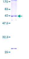 SETD4 Protein - 12.5% SDS-PAGE of human C21orf18 stained with Coomassie Blue