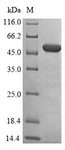 SETD7 / SET7 Protein - (Tris-Glycine gel) Discontinuous SDS-PAGE (reduced) with 5% enrichment gel and 15% separation gel.