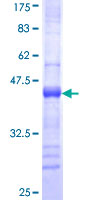 SETD7 / SET7 Protein - 12.5% SDS-PAGE Stained with Coomassie Blue.