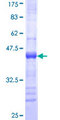 SETD7 / SET7 Protein - 12.5% SDS-PAGE Stained with Coomassie Blue.