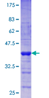 SETDB2 Protein - 12.5% SDS-PAGE Stained with Coomassie Blue.