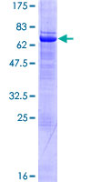 SETMAR Protein - 12.5% SDS-PAGE of human SETMAR stained with Coomassie Blue