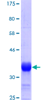 SETX / Senataxin Protein - 12.5% SDS-PAGE Stained with Coomassie Blue.