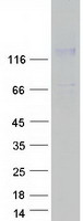 SEZ6 / SEZ-6 Protein - Purified recombinant protein SEZ6 was analyzed by SDS-PAGE gel and Coomassie Blue Staining