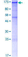SEZ6L Protein - 12.5% SDS-PAGE of human SEZ6L stained with Coomassie Blue