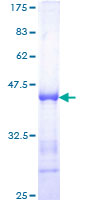 SF1 Protein - 12.5% SDS-PAGE Stained with Coomassie Blue.
