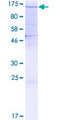 SF3A1 / SF3A120 Protein - 12.5% SDS-PAGE of human SF3A1 stained with Coomassie Blue