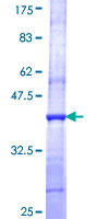 SF3A2 / SF3a66 Protein - 12.5% SDS-PAGE Stained with Coomassie Blue.