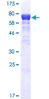 SF3A3 / SF3a60 Protein - 12.5% SDS-PAGE of human SF3A3 stained with Coomassie Blue