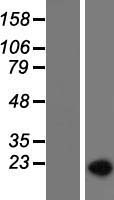 SF3B1 Protein - Western validation with an anti-DDK antibody * L: Control HEK293 lysate R: Over-expression lysate