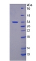 SF3B1 Protein - Recombinant Splicing Factor 3B Subunit 1 (SF3B1) by SDS-PAGE