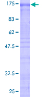 SF3B2 Protein - 12.5% SDS-PAGE of human SF3B2 stained with Coomassie Blue