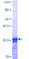 SF3B2 Protein - 12.5% SDS-PAGE Stained with Coomassie Blue.